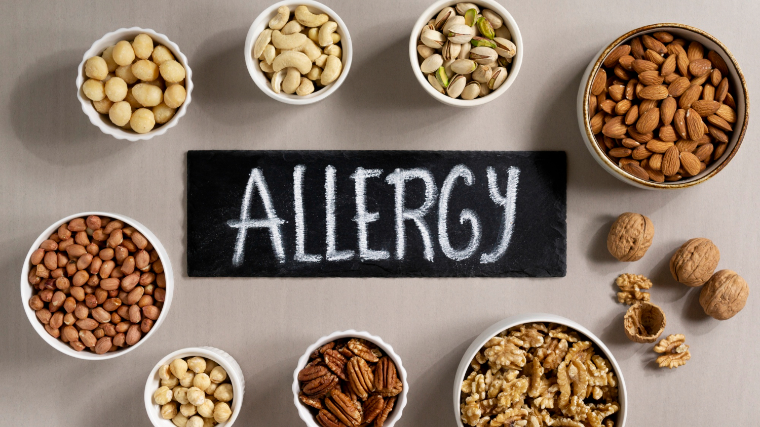 allergy foods